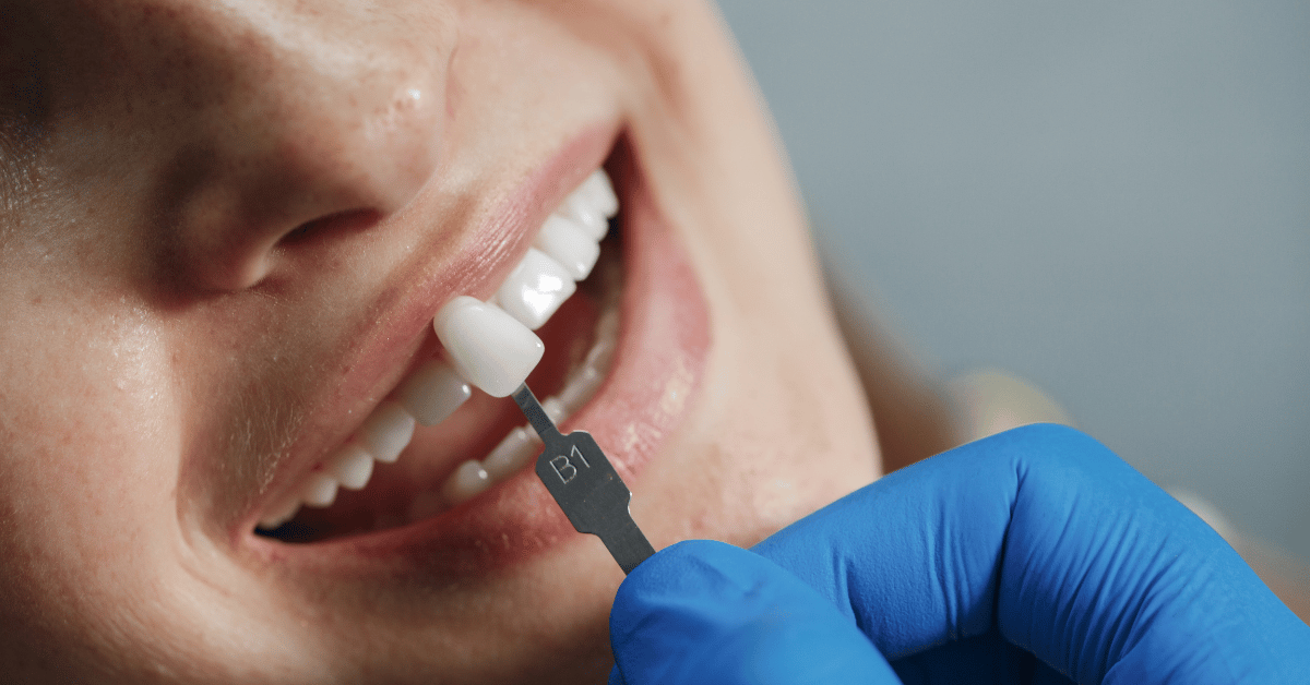 implant crown
