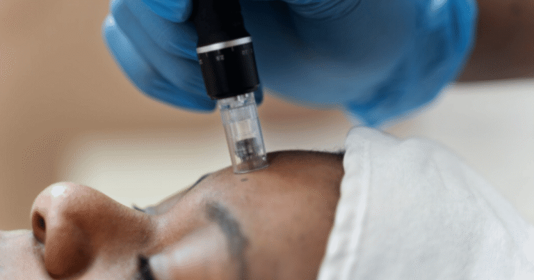 forehead lift
